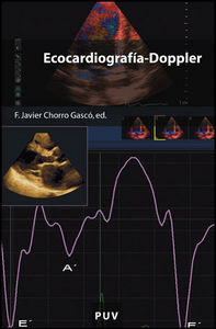 Ecocardiografía-Doppler, de Varios autores | portada del libro