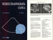 Neuroultrasonografia clinica, de Perez Higueras, Antonio | portada del libro