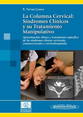TORRES CUECO:La Columna Cervical. T2, de TORRES CUECO, RAFAEL | portada del libro