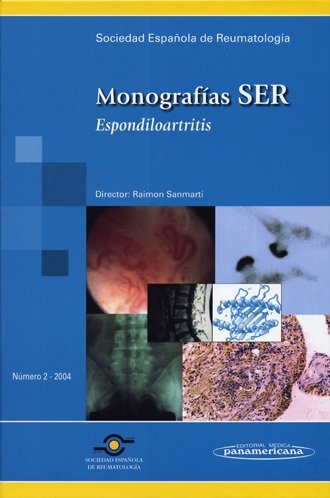 SER:Espondiloartritis, de SANMARTIN SALA, RAMON | portada del libro
