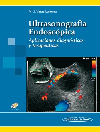 VARAS:UltrasonografÆa Endoscùpica, de VARAS LORENZO, MODESTO JOSE | portada del libro