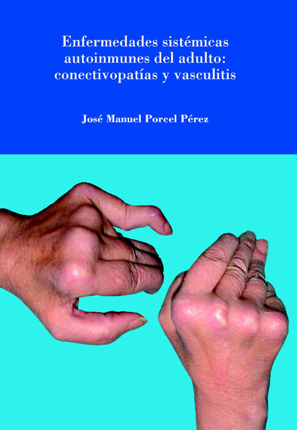 Enfermedades sistémicas autoinmunes del adulto: conectivopatías y vasculitis., de Porcel Pérez | portada del libro