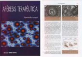 Aféresis terapeutica, de Anaya Fernández-Lomana, Fernando | portada del libro