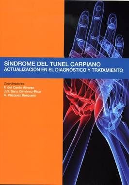 S¡ndrome del túnel carpiano, de CANTO ALVAREZ, FERNANDO DEL | portada del libro