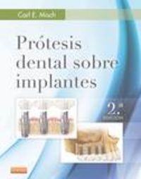 Prótesis dental sobre implantes (2ª ed.), de Misch, Carl E. | portada del libro