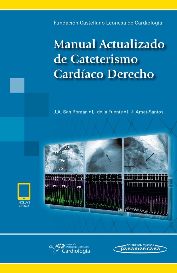 SAN ROMAN:Man.Actul.Cateter.Cardic.Dch+e, de SAN ROMAN, JA | portada del libro