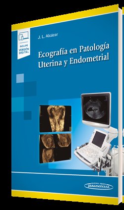 Ecografía en Patología Uterina y Endometrial, de Alcázar Zambrano, Juan Luis | portada del libro
