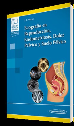 ECOGRAFIA EN REPRODUCCION ENDOMETRIOSIS DOLOR PELVICO Y SU | portada del libro