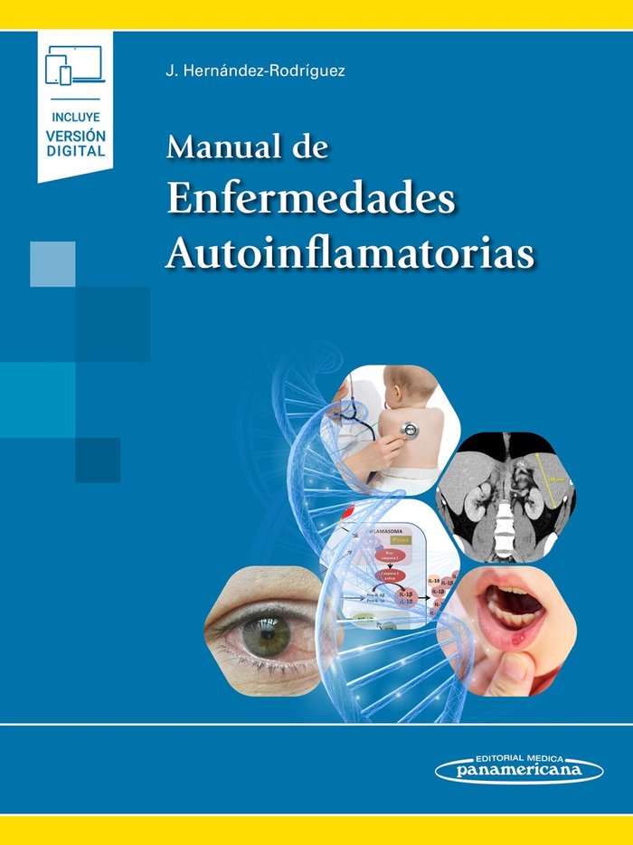 Manual de Enfermedades Autoinflamatorias, de AA.VV. | portada del libro
