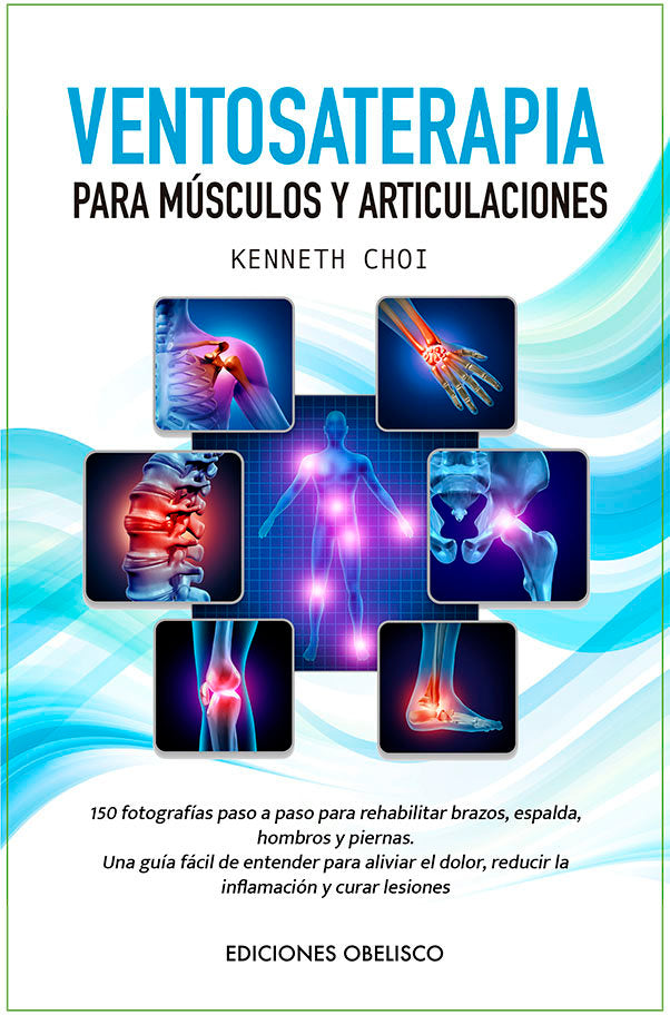 Ventosaterapia, de CHOI,KENNETH | portada del libro