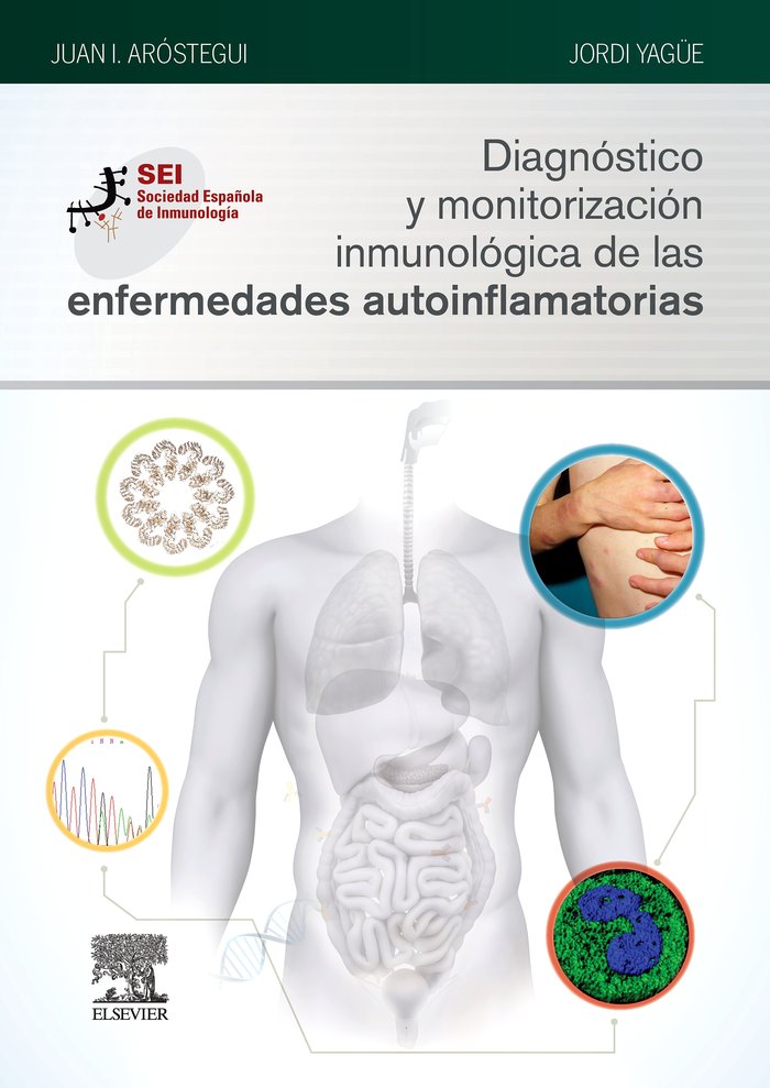 Diagnóstico y monitorización inmunológica de las enfermedades autoinflamatorias, de Aróstegui Gorospe, Juan Ignacio | portada