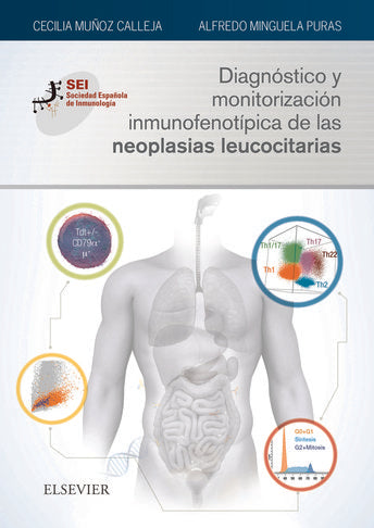 Diagnóstico y monitorización inmunofenotípica de las neoplasias leucocitarias, de Muñoz Calleja, Cecilia | portada del libro