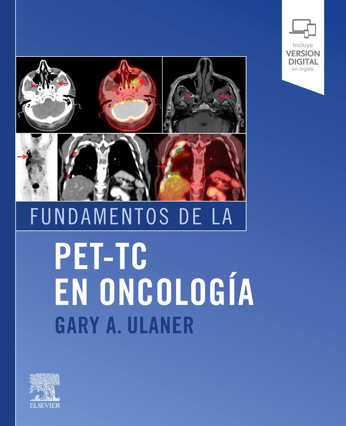 Fundamentos de la PET-TC en oncología, de Ulaner, Gary A. | portada del libro