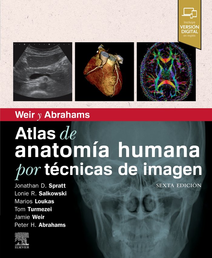 ENZINGER Y WEISS TUMORES DE PARTES BLANDAS, de SPRATT | portada del libro