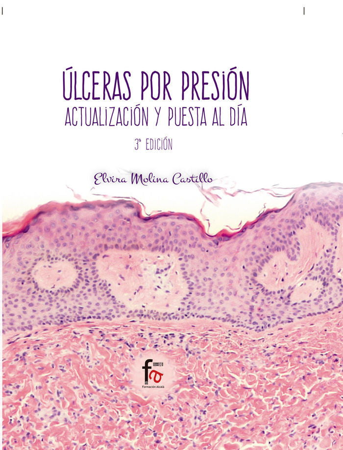 ULCERAS POR PRESION.-3 EDICION, de MOLINA CASTILLO, ELVIRA | portada del libro