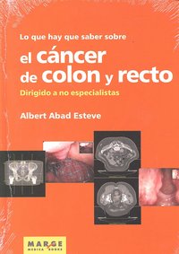 Lo que hay que saber sobre el cáncer de colon y recto, de Abad Esteve, Albert | portada del libro