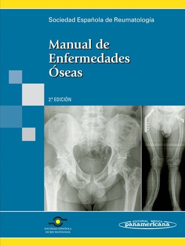 SER:Manual Enfermedades Oseas, de ARBOLEYA RODRIGUEZ, LUIS | portada del libro