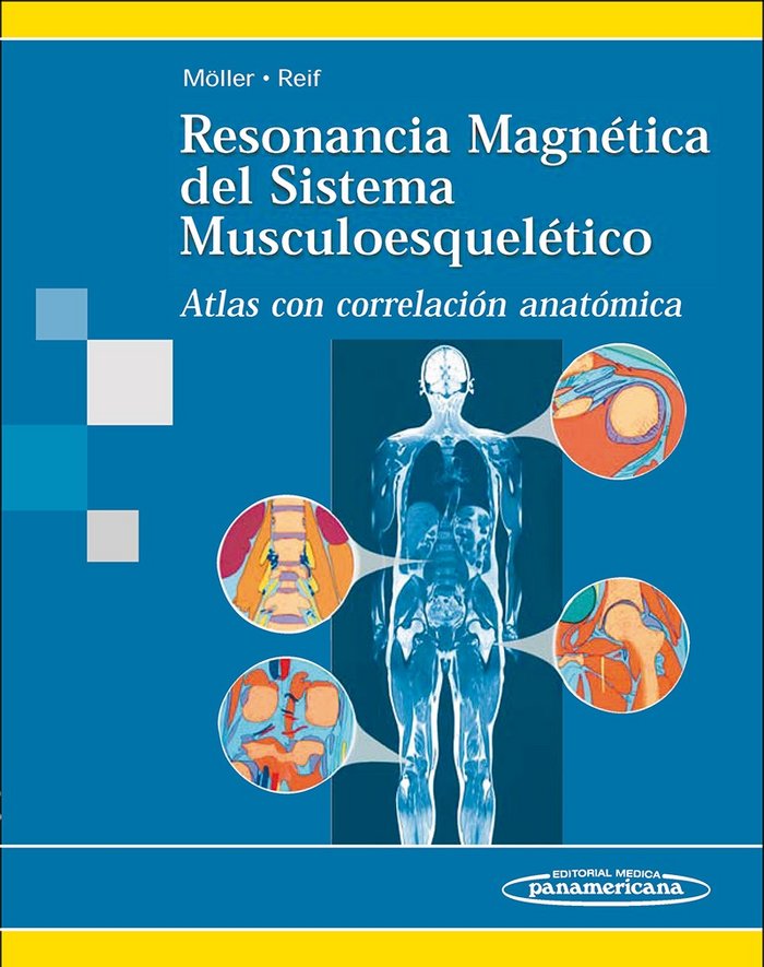 MOLLER:Reson. Magn. Sist. Musculoesque., de MOLLER, TORSTEN B. | portada del libro