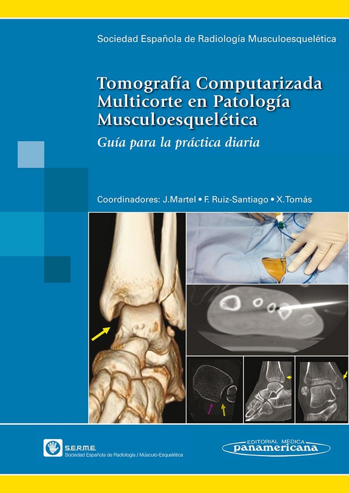SERME:TC Multicorte Patol. Musculo esque, de SERME SOCIEDAD ESPAÑOLA DE RADIOLOGIA MU | portada del libro