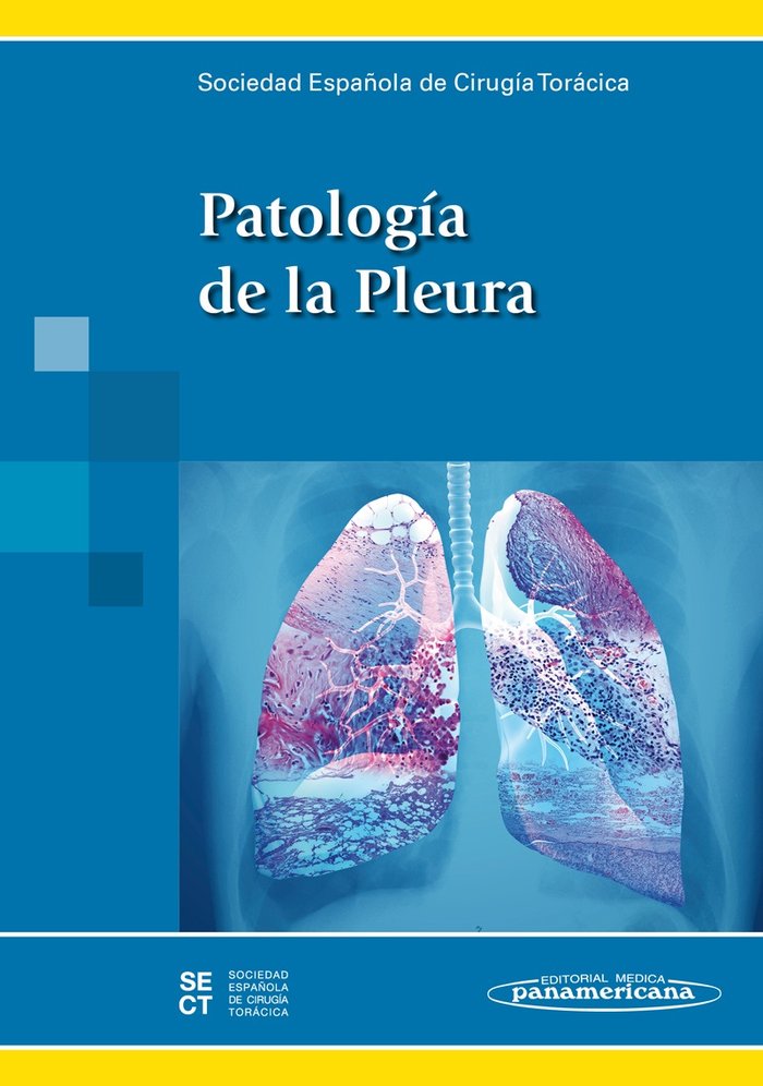 SECT:PatologÆa de la Pleura, de SOCIEDAD ESPAÑOLA DE CIRUGIA TORACICA | portada del libro