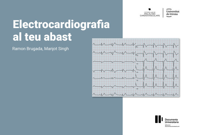 Electrocardiografia al teu abast, de BRUGADA TERRADELLAS, RAMON | portada del libro