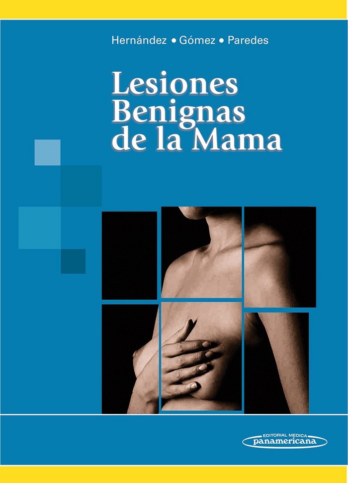 HERNANDEZ:Lesiones Benignas de la Mama, de HERNANDEZ MUÑOZ, GOMEZ, PAREDES | portada del libro