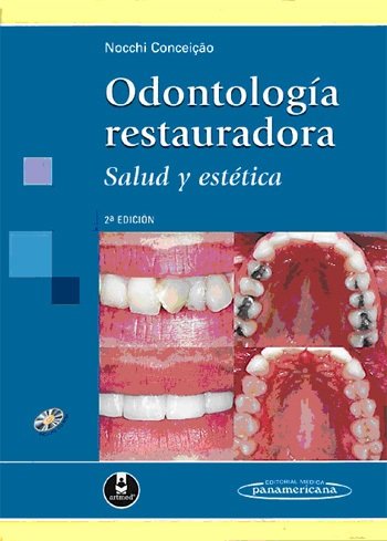 NOCCHI:OdontologÆa Restauradora +CD, de NOCCHI CONCEIÇÇO | portada del libro
