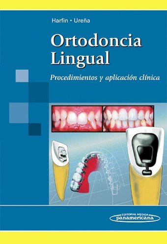 HARFIN-UREäA:Ortodoncia Lingual, de HARFIN, UREÑA RODRIGUEZ | portada del libro
