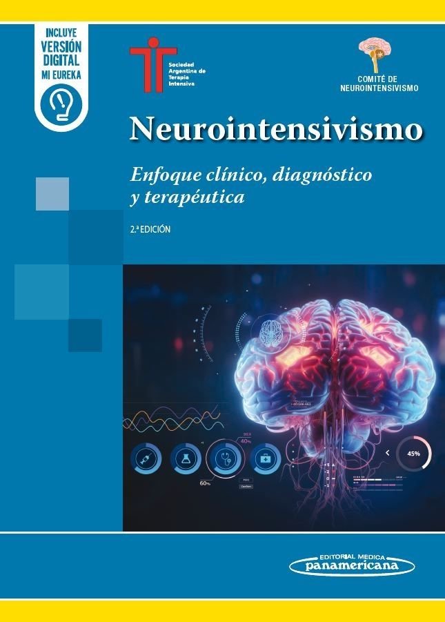 NEUROINTENSIVISMO 2ª ED, de SATI | portada del libro