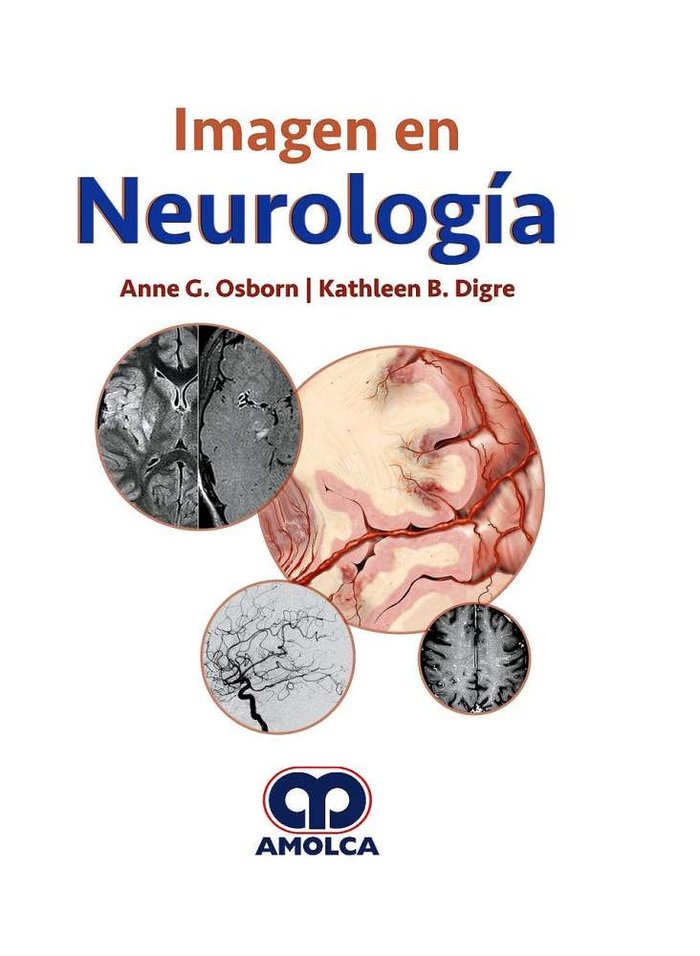 IMAGEN EN NEUROLOGIA, de OSBORN,A | portada del libro