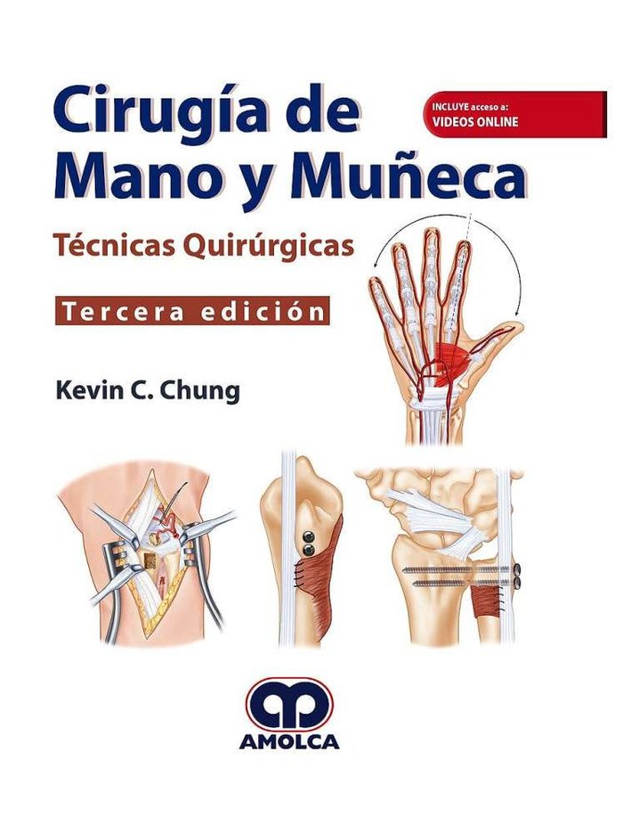 CIRUGIA DE MANO Y MUÑECA TECNICAS QUIRURGICAS, de CHUNG,C | portada del libro
