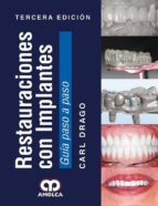 RESTAURACIONES CON IMPLANTES. GUIA PASO A PASO, de Varios autores | portada del libro