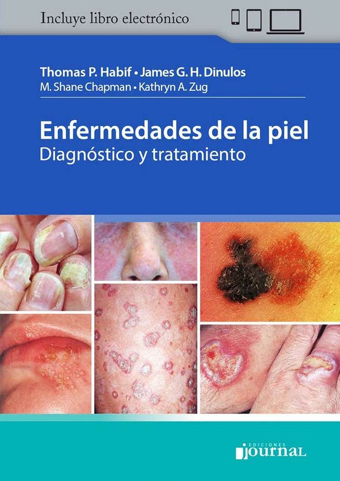 Enfermedades de la Piel. Diagnóstico y Tratamiento (Incluye Libro Electrónico), de HABIF,T | portada del libro