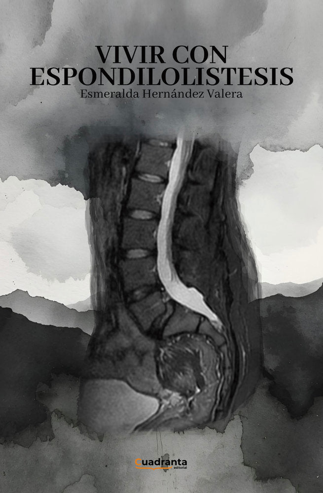 Vivir con espondilolistesis, de , Hernández Valera, Esmeralda | portada del libro
