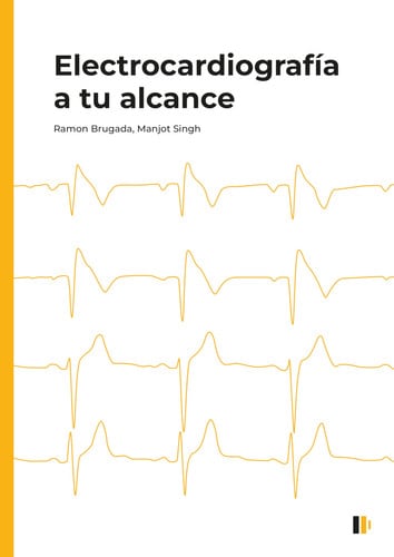 ELECTROCARDIOGRAFIA A TU ALCANCE, de BRUGADA TERRADELLAS | portada del libro