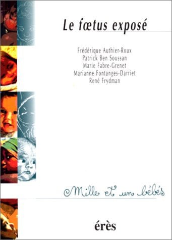1001 BB 018 FOETUS EXPOSE, de COLLECTIF | portada del libro