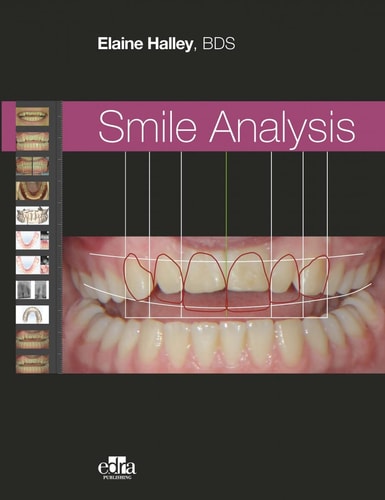 SMILE ANALYSIS, de HALLEY | portada del libro