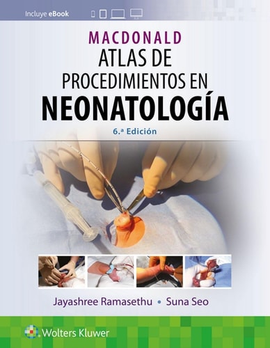 MACDONALD ATLAS DE PROCEDIMIENTOS EN NEONATOLOGIA 6ª ED, de RAMASETHU | portada del libro