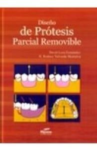 DISEñO DE PRóTESIS PARCIAL REMOVIBLE, de LOZA#VALVERDE | portada del libro