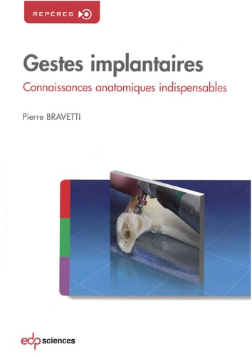 GESTES IMPLANTAIRES,CONNAISSANCES ANATOMIQUES INDISPENSABLES, de BRAVETTI | portada del libro