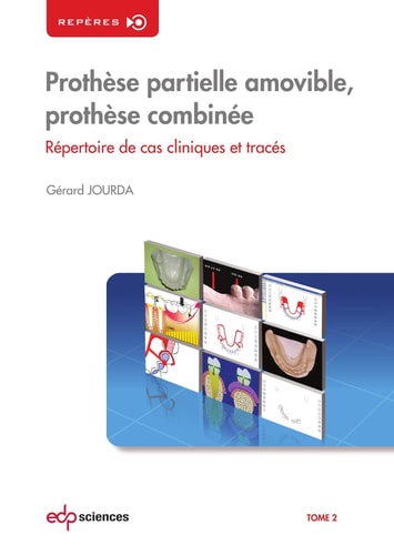 PROTHESE PARTIELLE AMOVIBLE T2, de Gérard Jourda | portada del libro