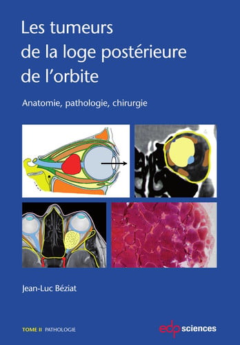 LES TUMEURS DE LA LOGE POSTERIEURE DE L'ORBITE TOME 2, de BEZIAT JEAN-LUC | portada del libro