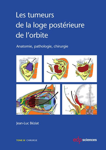 TUMEURS DE LA LOGE POSTERIEURE DE L'ORBITE LES TOME 3, de JEAN-LUC BEZIAT | portada del libro