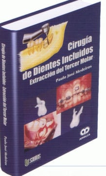 MEDEIROS CIRUGIA DE DIENTES INCLUIDOS, de PAULO JOSE MEDEIROS | portada del libro