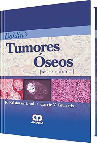 TUMORES OSEOS | portada del libro