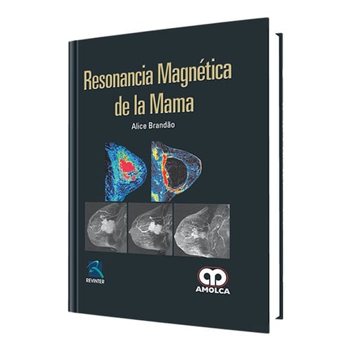 RESONANCIA MAGNETICA DE LA MAMA | portada del libro