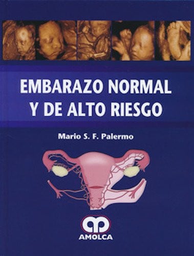 PALERMO EMBARAZO NORMAL Y DE ALTO RIESGO | portada del libro