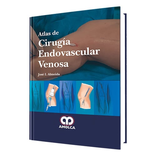 ALMEIDA ATLAS DE CIRUGIA ENDOVASCULAR VENOSA | portada del libro