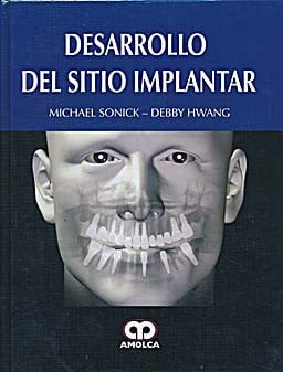 SONICK DESARROLLO DEL SITIO IMPLANTAR | portada del libro
