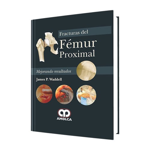 WADDELL FRACTURAS DEL FEMUR PROXIMAL | portada del libro